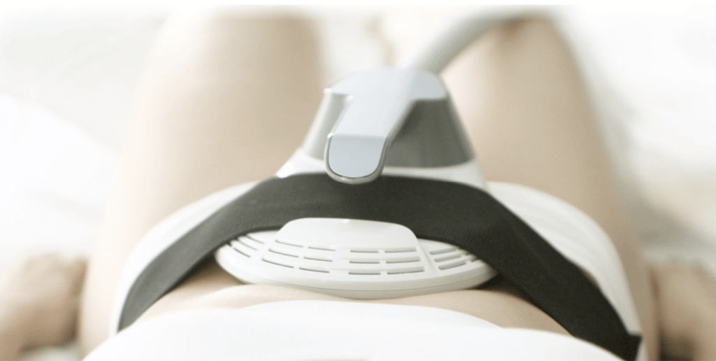 What is Emsculpt